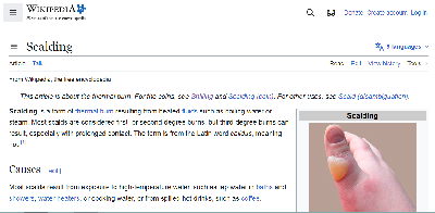 scalding.png
